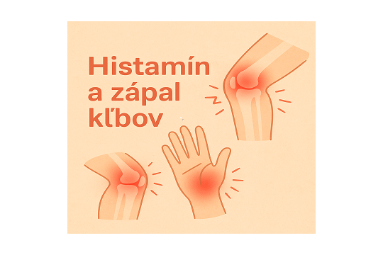 Ako súvisí histamín a zápal kĺbov